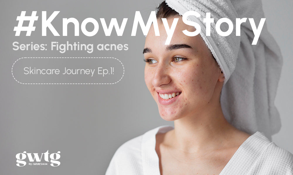 #KnowMyStory Series: Fighting acnes